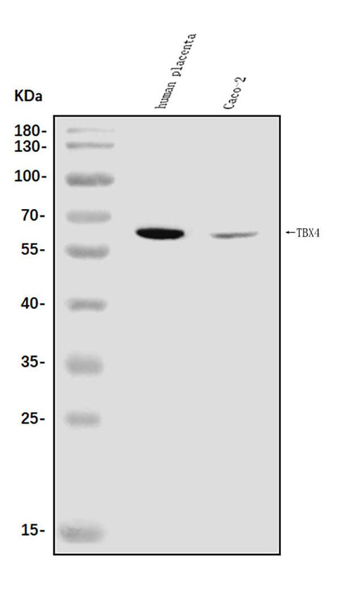 Anti-TBX4 Antibody Picoband® Boster Bio