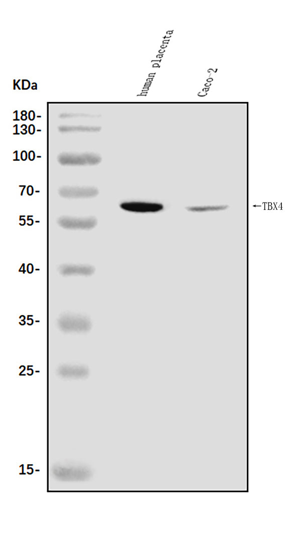 Anti-TBX4 Antibody Picoband® Boster Bio