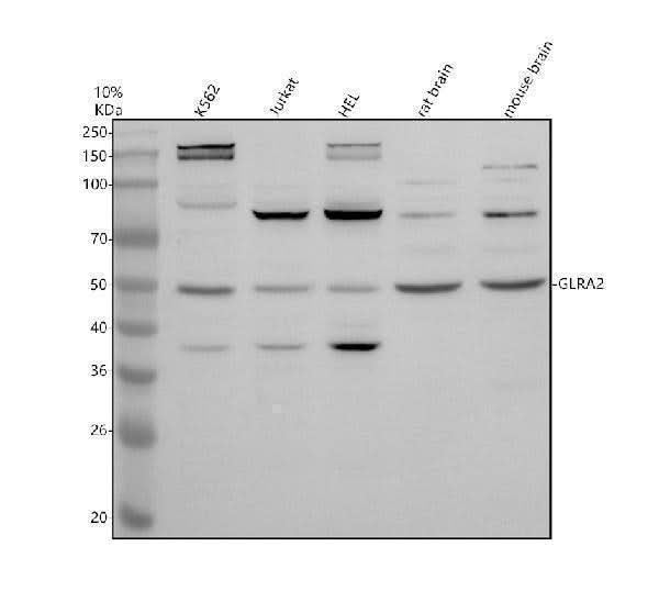 Anti-GLRA2 Antibody Picoband® Boster Bio