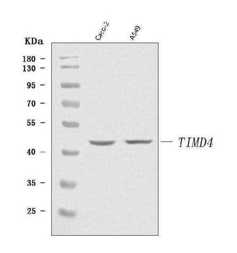 Anti-TIM 4/TIMD4 Antibody Picoband® Boster Bio