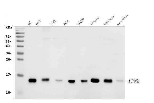 Anti-Profilin 2/PFN2 Antibody Picoband® Boster Bio