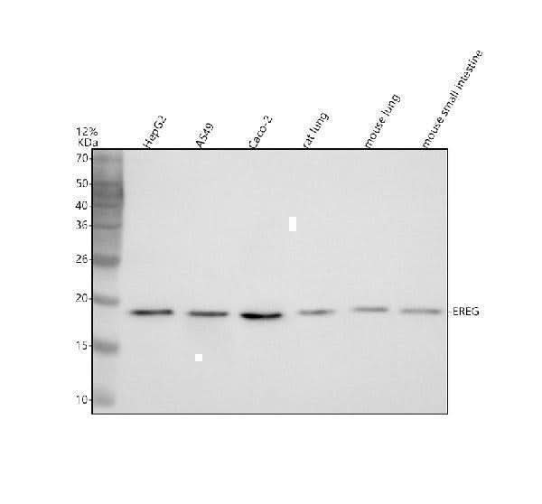 Anti-EREG Antibody Picoband® Boster Bio