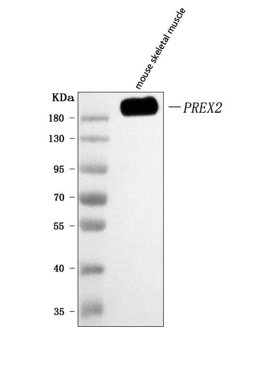 Anti-PREX2 Antibody Picoband® Boster Bio