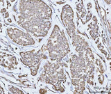 Anti-PPM1G Antibody Picoband® Boster Bio