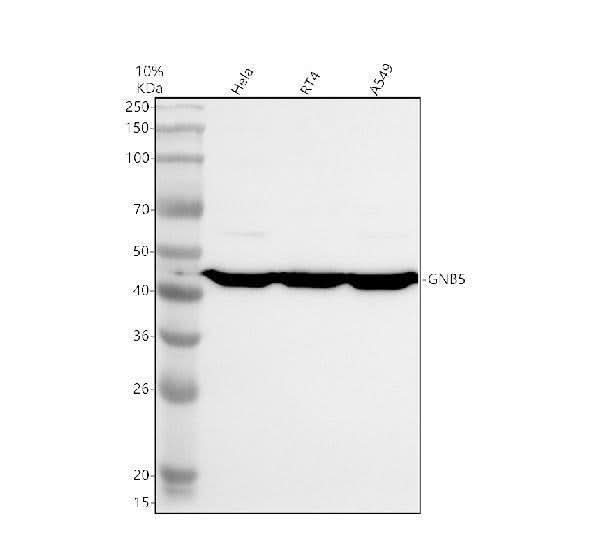 Anti-GNB5 Antibody Picoband® Boster Bio