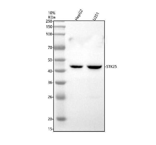 Anti-DUSP12 Antibody Picoband® Boster Bio