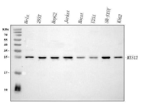 Anti-MIS12 Antibody Picoband® Boster Bio