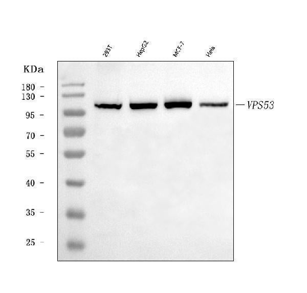 Anti-VPS53 Antibody Picoband® Boster Bio
