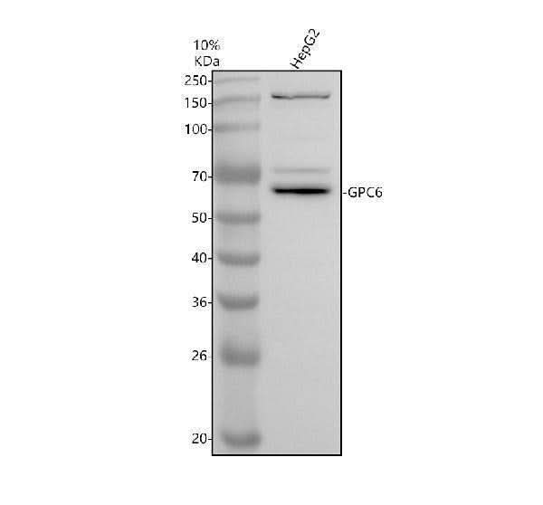 Anti-Glypican 6/GPC6 Antibody Picoband® Boster Bio