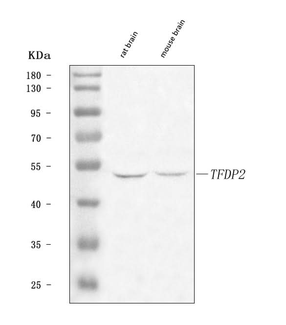 Anti-DP2/TFDP2 Antibody Picoband® Boster Bio
