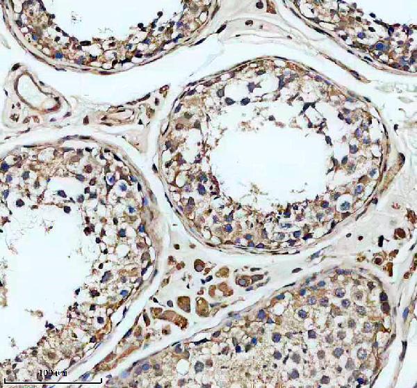 Anti-SLC22A16 Antibody Boster Bio