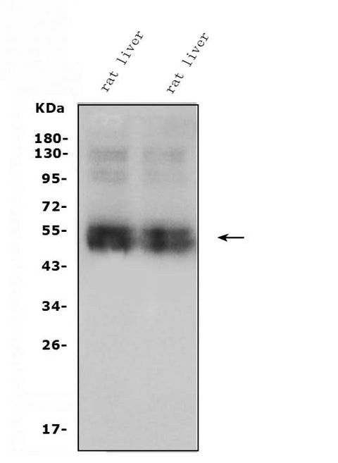 Anti-SLC10A1/NTCP1 Antibody Picoband® Boster Bio