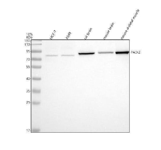Anti-PADI2 Antibody Picoband® Boster Bio