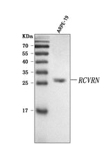 Anti-Recoverin/RCVRN Antibody Picoband® Boster Bio