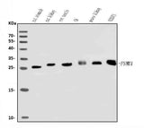 Anti-Psmb1 Antibody Picoband® Boster Bio