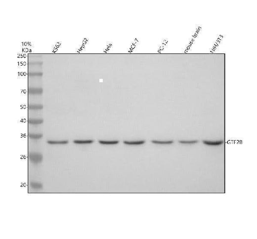 Anti-GTF2B Antibody Picoband® Boster Bio