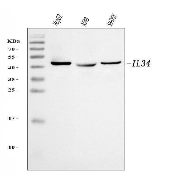 Anti-IL34 Antibody Picoband® Boster Bio