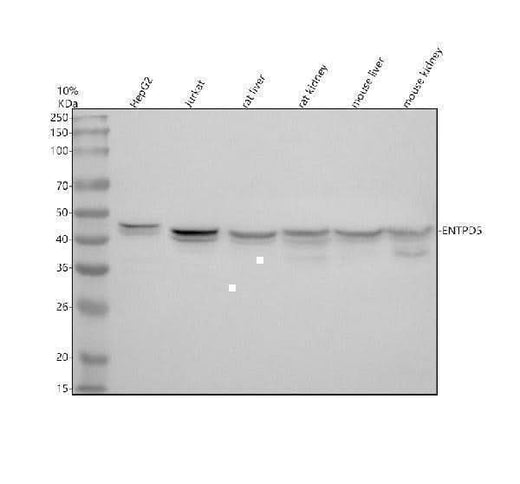 Anti-ENTPD5 Antibody Picoband® Boster Bio