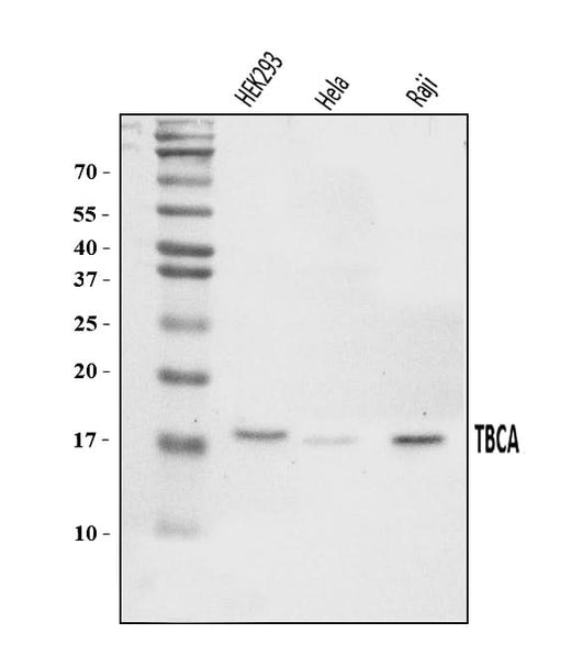 Anti-CFA/TBCA Antibody Picoband® Boster Bio