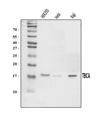Anti-CFA/TBCA Antibody Picoband® Boster Bio