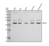 Anti-DUSP23 Antibody Picoband® Boster Bio