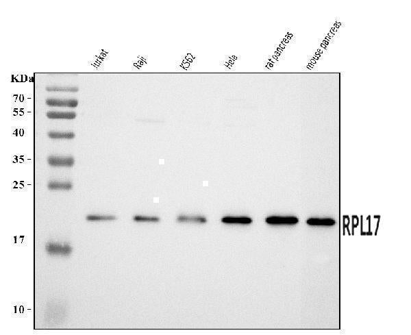 Anti-RPL17 Antibody Picoband® Boster Bio