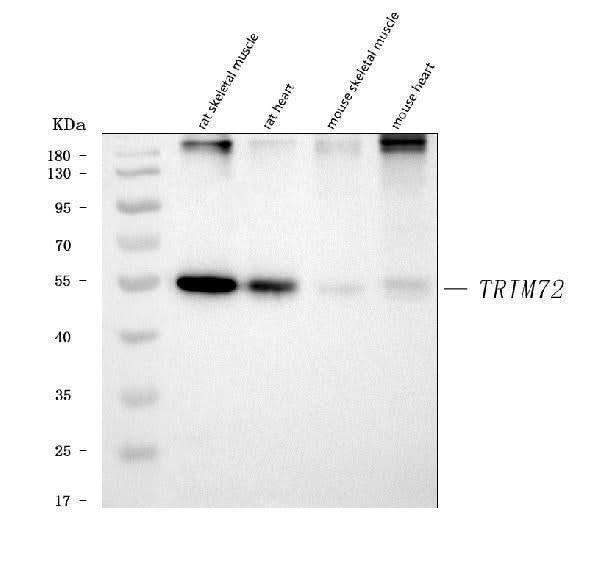 Anti-MG53/TRIM72 Antibody Picoband® Boster Bio