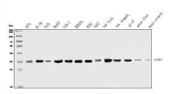 Anti-TRAP alpha/TRAPA/SSR1 Antibody Picoband® Boster Bio