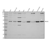 Anti-Periphilin 1/PPHLN1 Antibody Picoband® Boster Bio
