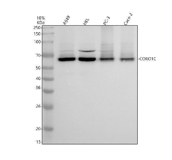 Anti-CORO1C Antibody Picoband® Boster Bio