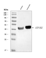 Anti-ATP1B2 Antibody Picoband® Boster Bio