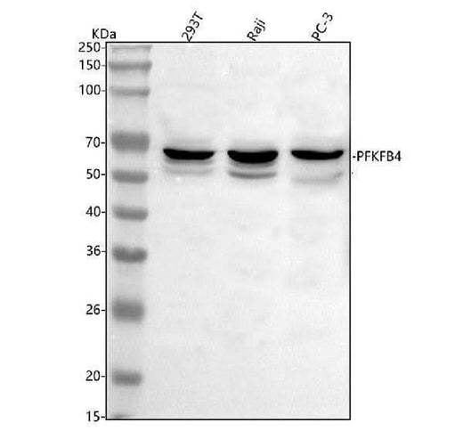 Anti-PFKFB4 Antibody Picoband® Boster Bio