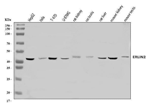 Anti-Erlin-2/ERLIN2 Antibody Picoband® Boster Bio