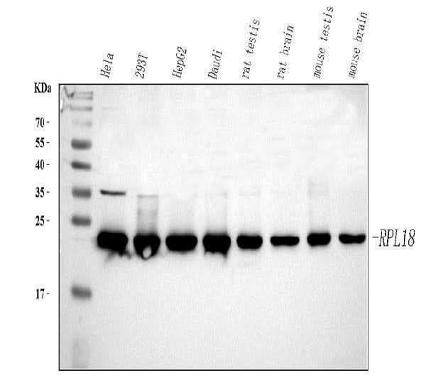 Anti-RPL18 Antibody Picoband® Boster Bio