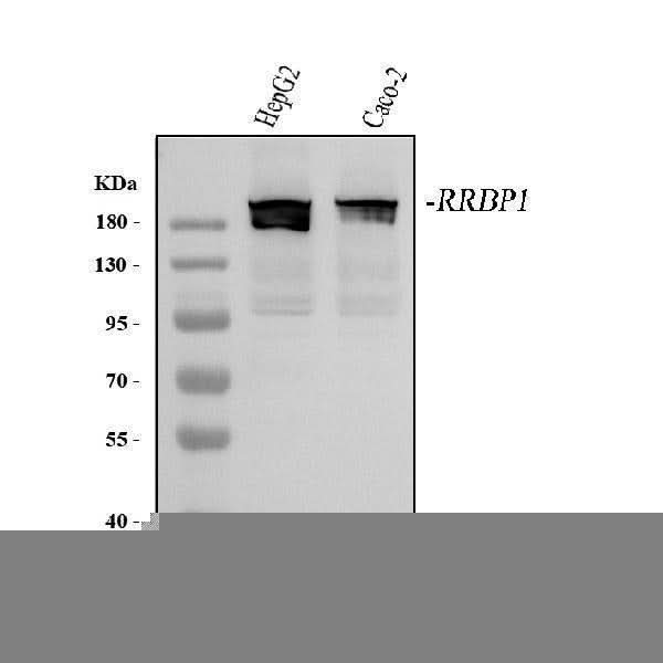 Anti-RRBP1 Antibody Picoband® Boster Bio