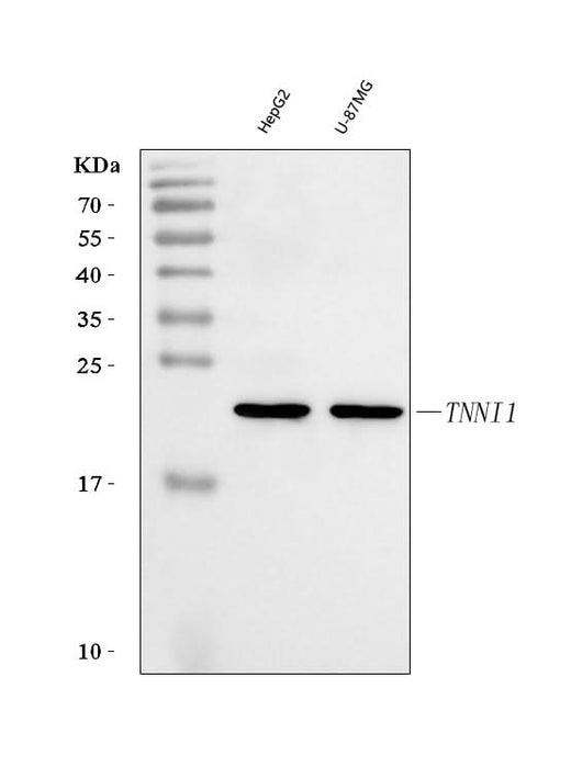 Anti-TNNI1 Antibody Picoband® Boster Bio