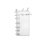 Anti-EVC2 Antibody Picoband® Boster Bio