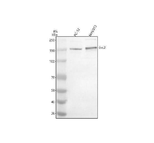 Anti-EVC2 Antibody Picoband® Boster Bio