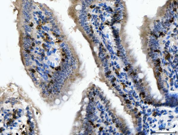Anti-CD103/Itgae Antibody Boster Bio
