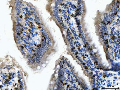 Anti-CD103/Itgae Antibody Boster Bio