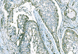 Anti-CD101 Antibody Boster Bio