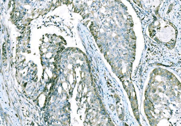 Anti-CD101 Antibody Boster Bio