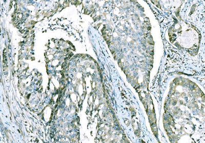Anti-CD101 Antibody Boster Bio