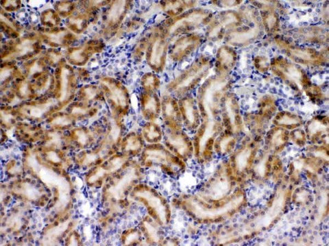 Anti-TIMP4 Antibody Picoband® Boster Bio