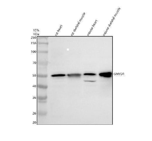 Anti-SMYD1 Antibody Picoband® Boster Bio