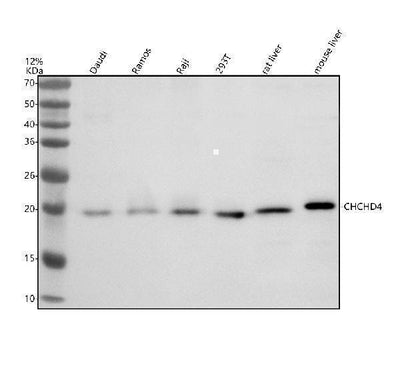 Anti-DZIP1 Antibody Picoband® Boster Bio