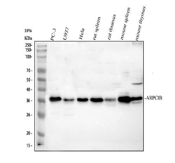 Anti-ARP2/3 subunit 1B/ARPC1B Antibody Picoband® Boster Bio