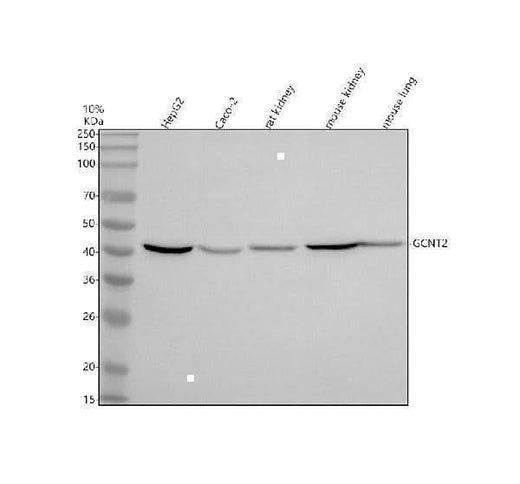 Anti-GCNT2 Antibody Picoband® Boster Bio