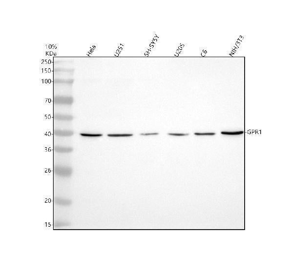Anti-CMKLR2 Antibody Picoband® Boster Bio