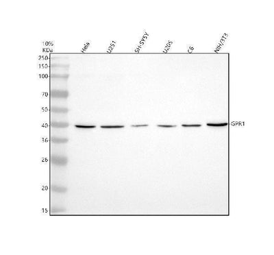 Anti-CMKLR2 Antibody Picoband® Boster Bio